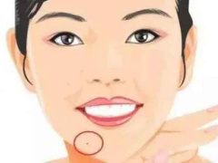 Ảnh bìa bài viết 825162