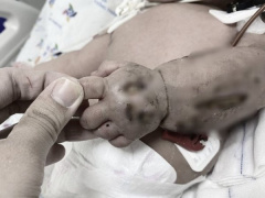 Ảnh bìa bài viết 826943