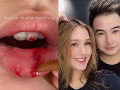 Ảnh bìa bài viết 827449