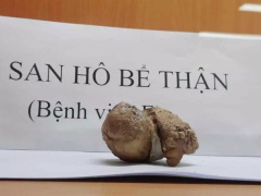 Ảnh bìa bài viết 830357