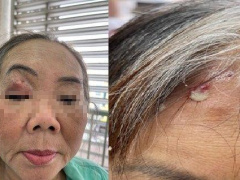 Ảnh bìa bài viết 832099