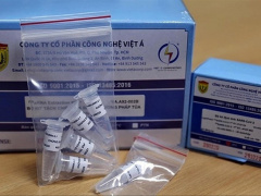 Ảnh bìa bài viết 834364
