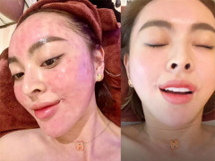 Ảnh bìa bài viết 836238