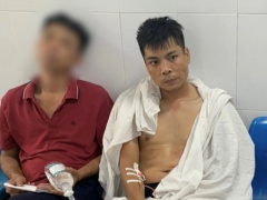 Ảnh bìa bài viết 836621