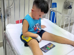 Ảnh bìa bài viết 836729