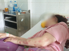 Ảnh bìa bài viết 838269
