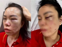 Ảnh bìa bài viết 841065