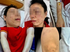 Ảnh bìa bài viết 841495
