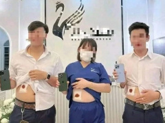 Ảnh bìa bài viết 841629