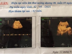 Ảnh bìa bài viết 841793