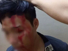 Ảnh bìa bài viết 842393