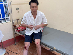 Ảnh bìa bài viết 845215