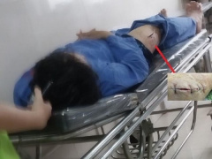 Ảnh bìa bài viết 846790