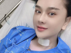 Ảnh bìa bài viết 847710