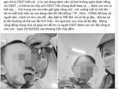 Ảnh bìa bài viết 847779