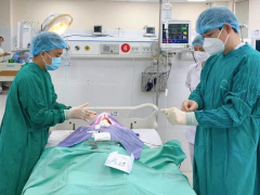 Ảnh bìa bài viết 847959