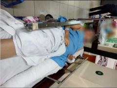 Ảnh bìa bài viết 848836
