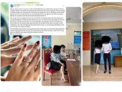 Ảnh bìa bài viết 849215