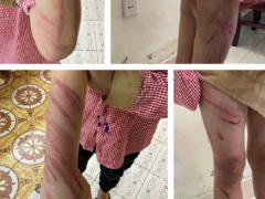 Ảnh bìa bài viết 849577