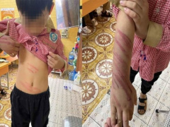 Ảnh bìa bài viết 849808