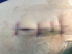 Ảnh bìa bài viết 855024