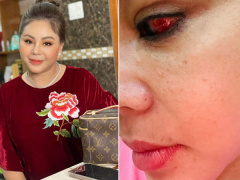 Ảnh bìa bài viết 855062