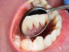 Ảnh bìa bài viết 857131