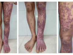 Ảnh bìa bài viết 857227