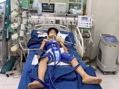 Ảnh bìa bài viết 860185