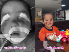Ảnh bìa bài viết 863551