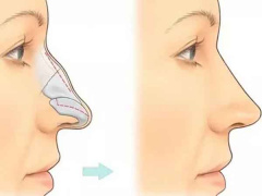 Ảnh bìa bài viết 864208