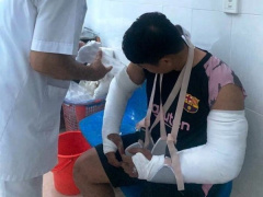 Ảnh bìa bài viết 864899