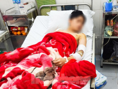 Ảnh bìa bài viết 865147