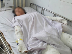 Ảnh bìa bài viết 865658