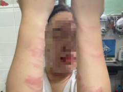 Ảnh bìa bài viết 865950