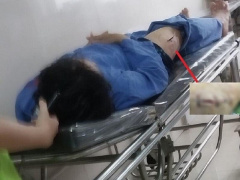 Ảnh bìa bài viết 871642