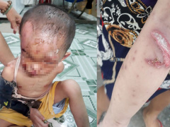 Ảnh bìa bài viết 873439