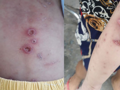 Ảnh bìa bài viết 873641