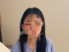 Ảnh bìa bài viết 874819