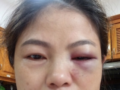 Ảnh bìa bài viết 876705