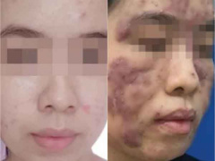 Ảnh bìa bài viết 877501