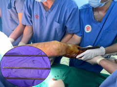 Ảnh bìa bài viết 878298