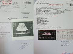 Post cover 878619
