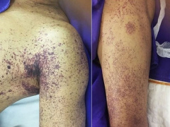 Ảnh bìa bài viết 878897
