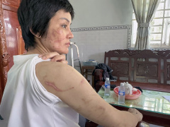 Ảnh bìa bài viết 879117