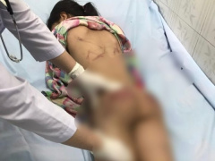 Ảnh bìa bài viết 880919