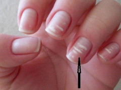 Ảnh bìa bài viết 881744
