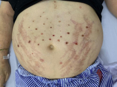 Ảnh bìa bài viết 883459