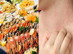 Ảnh bìa bài viết 884285
