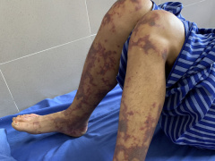 Ảnh bìa bài viết 884439